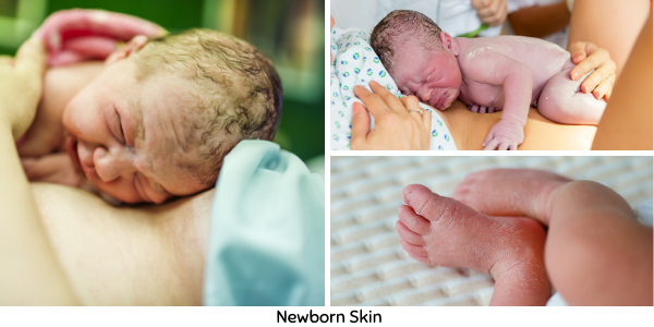 Close up pics of baby's skin when first born